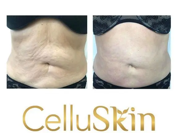 celluskin st-jean-sur-richelieu
